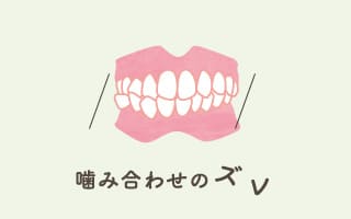 噛み合わせのズレ