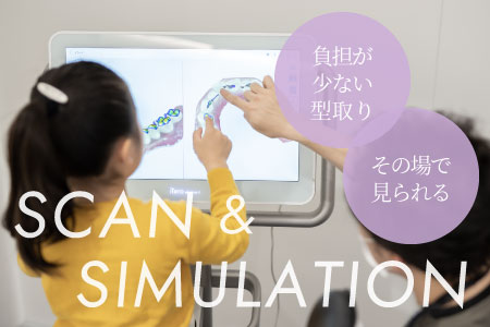 負担が少ない型取り その場で見られる